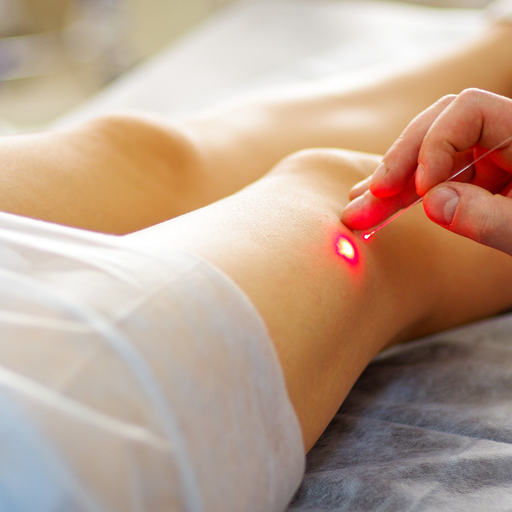 Laser Treatments for Skin in London