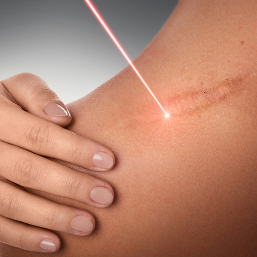 Laser Treatments for Skin - example of the work